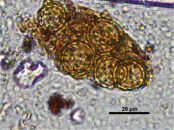 pollen of Chenopodiaceae by UPVEHU