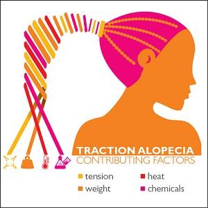 Traction Alopecia by Johns Hopkins Medicine