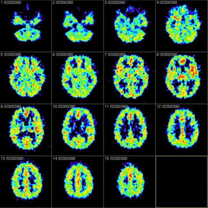 Brainscans showing intentional forgetting