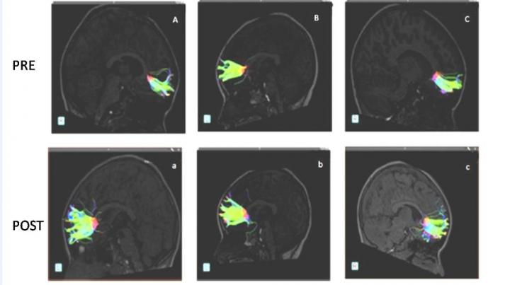 musical training and the brain