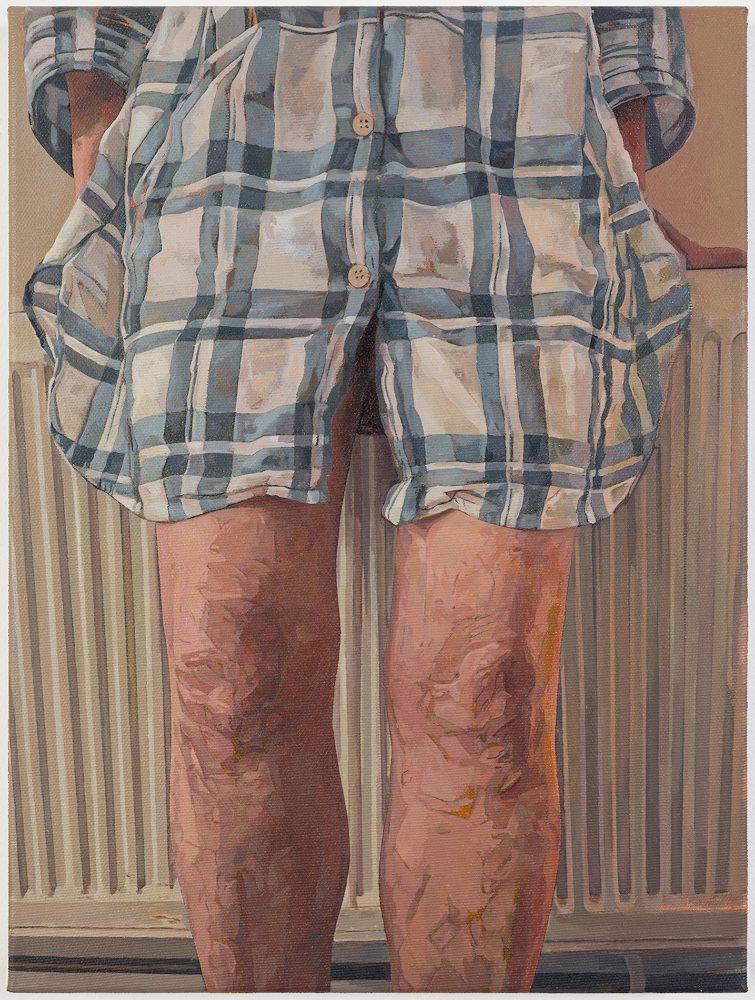 Michalis Karaiskos, Untitled (Partner), 2025
