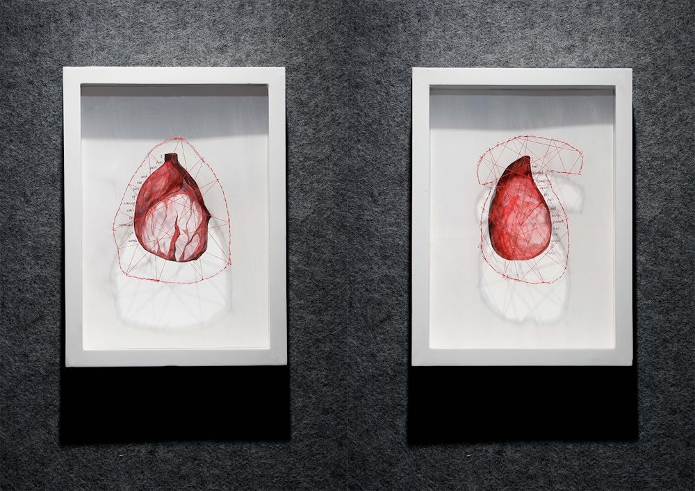 Anning Song, The Hidden Scar, 2022